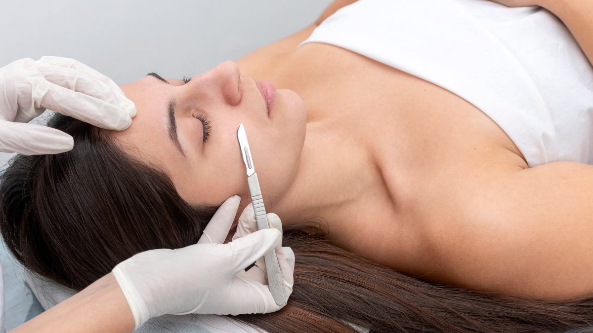 dermaplaning treatment