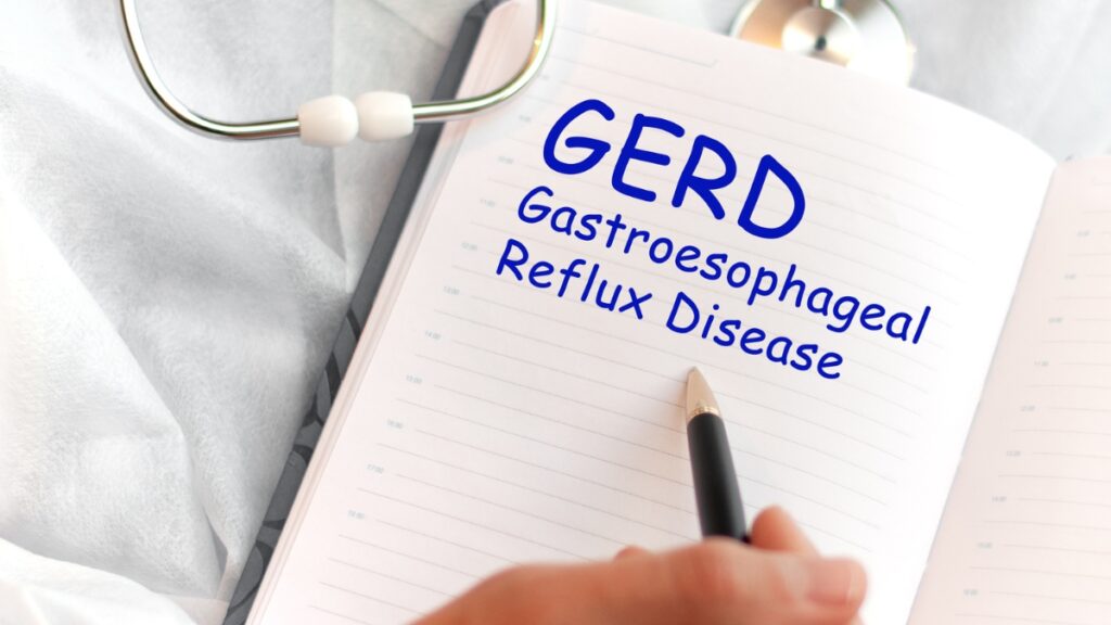 GERD Gastroesophageal Reflux Disease