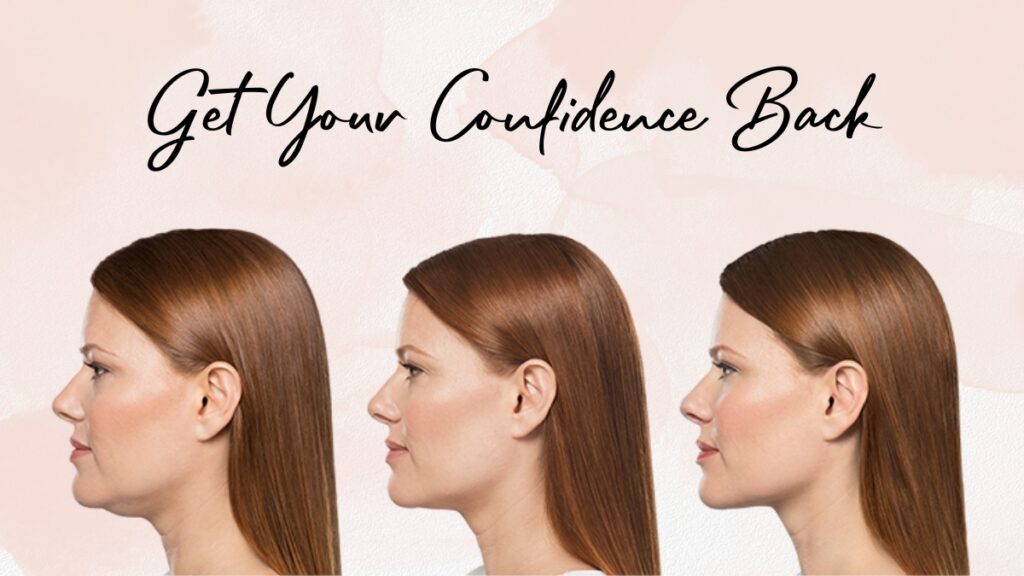 get back your confidence with kybella. ditch the double chin