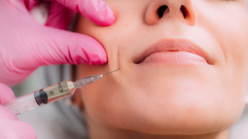 get the most out of your dermal filler