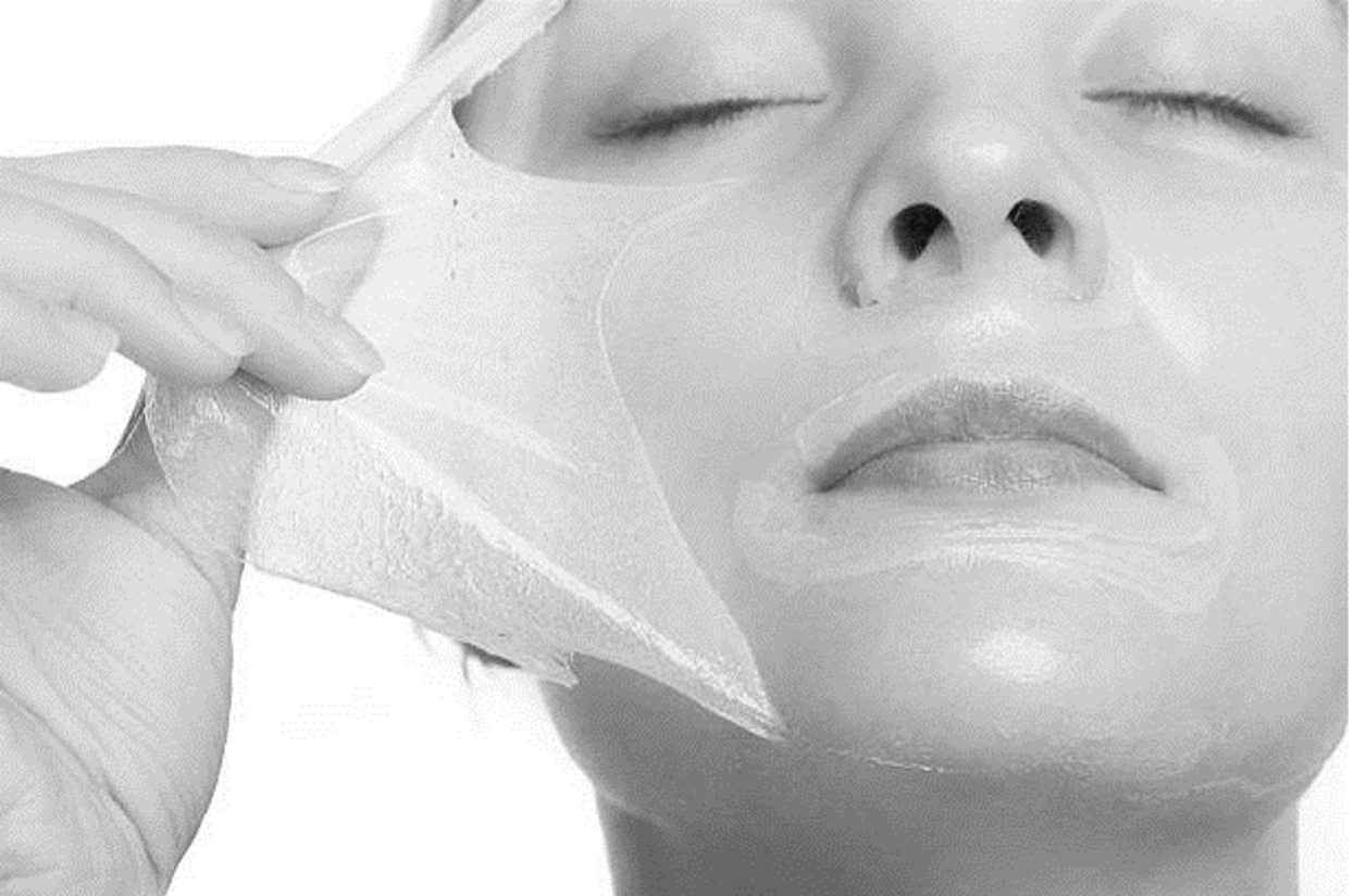 chemical peel