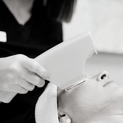 profractional-laser-treatment