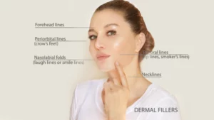 dermal fillers near me