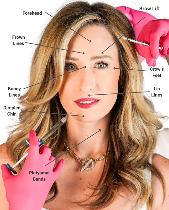 where can you get botox?